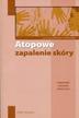 praca zbiorowa - Atopowe zapalenie skóry. Poradnik lekarza praktyka