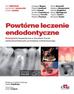 Bertani P., Gagliani M., Gorni F. - Powtórne leczenie endodontyczne 