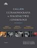 Scoutt L.M., Norton M.E., Feldstein V.A. - Callen. Ultrasonografia w położnictwie.. T.4