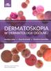 Lallas A., Errichetti E.,Ioannides D. - Dermatoskopia w dermatologii ogólnej 