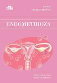 Endometrioza 